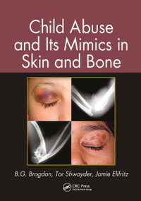 Child Abuse and its Mimics in Skin and Bone by B. G. Brogdon, Tor Shwayder, Jamie Elifritz, 9780367778187