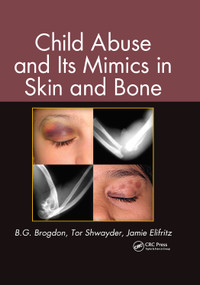 Child Abuse and its Mimics in Skin and Bone by B. G. Brogdon, Tor Shwayder, Jamie Elifritz, 9781439855355