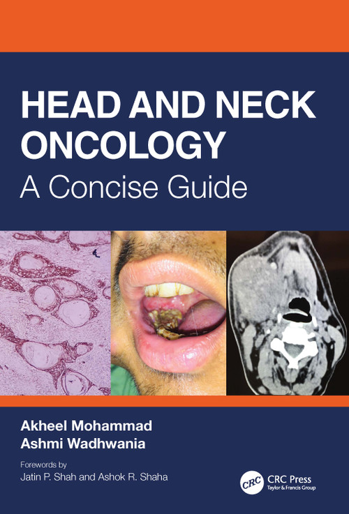 Head and Neck Oncology (A Concise Guide) by Akheel Mohammad, Ashmi Wadhwania, 9780367421311