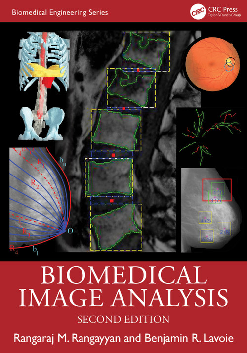 Biomedical Image Analysis by Rangaraj M. Rangayyan, Benjamin R. Lavoie, 9781032488172