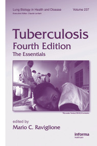 Tuberculosis (The Essentials, Fourth Edition) by Mario C. Raviglione, 9781420090215