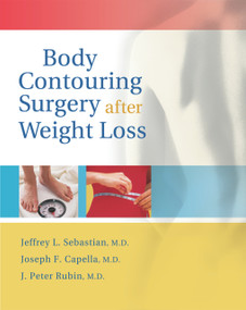 Body Contouring Surgery After Weight Loss by Jeffrey L. Sebastian, Joseph F. Capella, J. Peter Rubin, 9781886039186