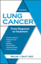 Lung Cancer (From Diagnosis to Treatment) by Walter Scott, 9781943886678