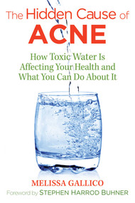 The Hidden Cause of Acne (How Toxic Water Is Affecting Your Health and What You Can Do about It) by Melissa Gallico, Stephen Harrod Buhner, 9781620557099