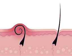 Prevent Ingrown Hairs Razor Bumbs Rash And Cuts With Priva Shave