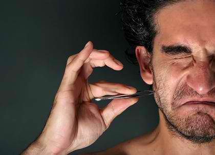 Ingrown Hair And Poor Shaving Technique Body4real