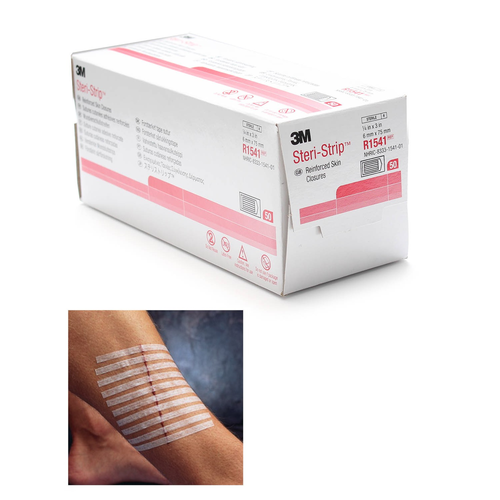 3M Steri Strip Adhesive Skin Closure Strips, 6 x 75mm Four Square