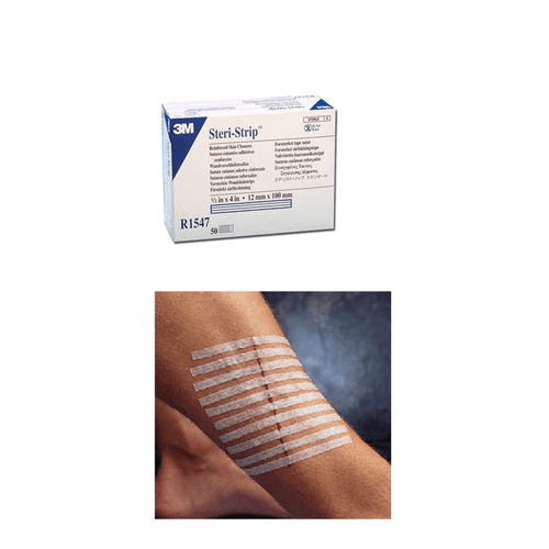 Steri Strip Adhesive Skin Closure Strips, 12 x 100mm Four Square Healthcare