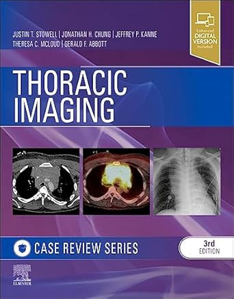 Thoracic Imaging: Case Review