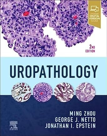 Uropathology