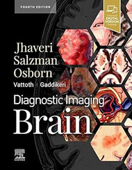 Diagnostic Imaging: Brain