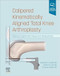 Calipered Kinematically aligned Total Knee Arthroplasty