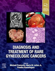Diagnosis and Treatment of Rare Gynecologic Cancers