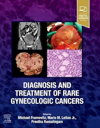 Diagnosis and Treatment of Rare Gynecologic Cancers