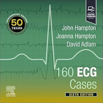 160 ECG Cases