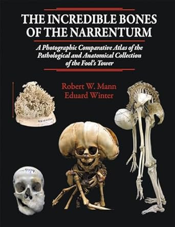 The Incredible Bones of the Narrenturm