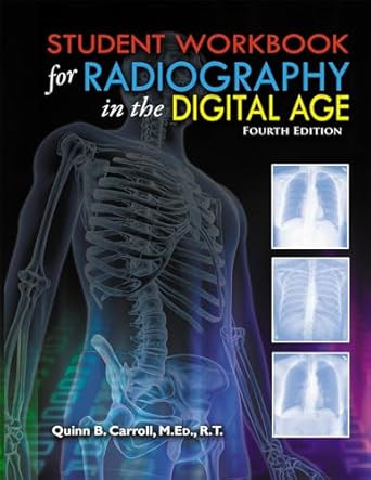 Radiography in the Digital Age