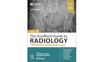 The Unofficial Guide to Radiology: 100 Practice Abdominal X-rays