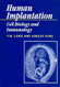 Human Implantation