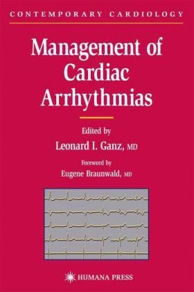 Management Of Cardiac Arrhythmias