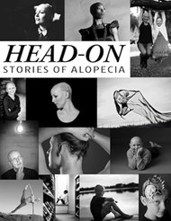 Head-On Stories of Alopecia
