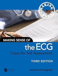 Making Sense of the ECG