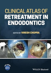 Clinical Atlas of Retreatment in Endodontics