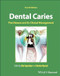 Dental Caries