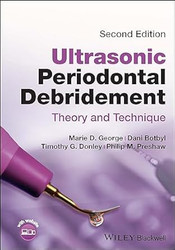 Ultrasonic Periodontal Debridement
