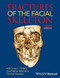 Fractures of the Facial Skeleton