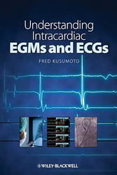 Understanding Intracardiac EGMs and ECGs
