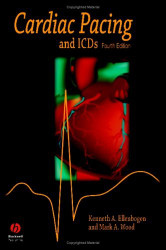 Cardiac Pacing And Icds