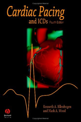 Cardiac Pacing And Icds