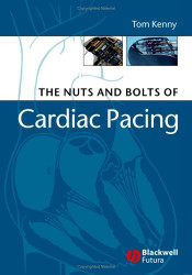 Nuts And Bolts Of Cardiac Pacing