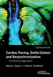 Cardiac Pacing Defibrillation and Resynchronization