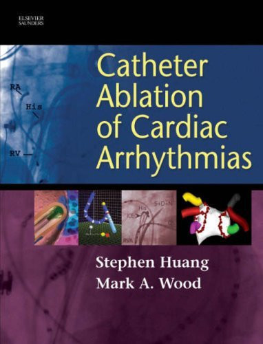 Catheter Ablation Of Cardiac Arrhythmias