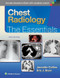 Chest Radiology: The Essentials Chest Radiology: The Essentials