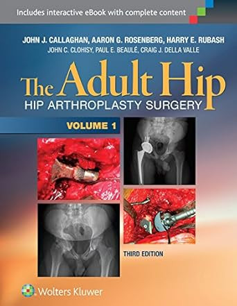 The Adult Hip