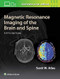 Magnetic Resonance Imaging of the Brain and Spine