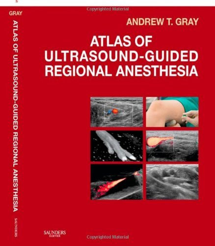 Atlas Of Ultrasound-Guided Regional Anesthesia