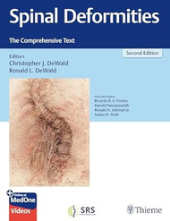 Spinal Deformities