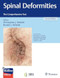Spinal Deformities