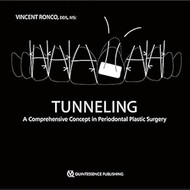 Tunneling