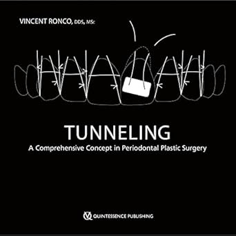 Tunneling