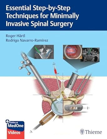 Essential Step-by-Step Techniques for Minimally Invasive