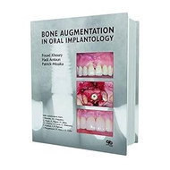 Bone Augmentation in Oral Implantology