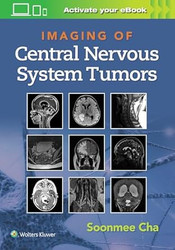 Imaging of Central Nervous System Tumors