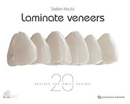 Laminate Veneers