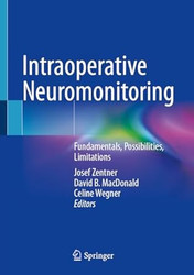 Intraoperative Neuromonitoring