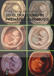 3D Ultrasound in Prenatal Diagnosis